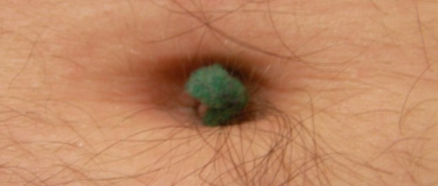 belly button with lint